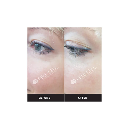 Beautycell LED Beauty Device