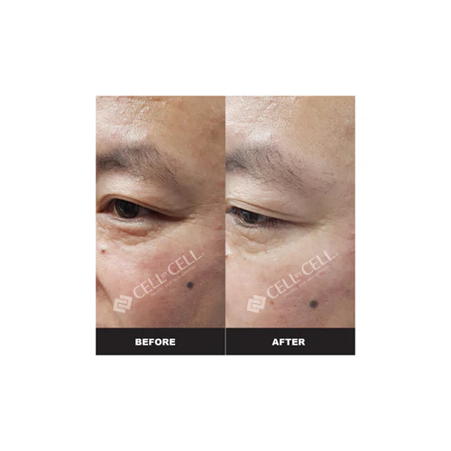 Beautycell LED Beauty Device